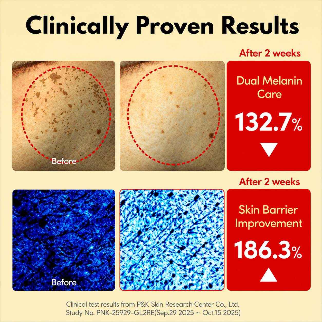 Erase Years of Dark Spots From Your Face and Body
